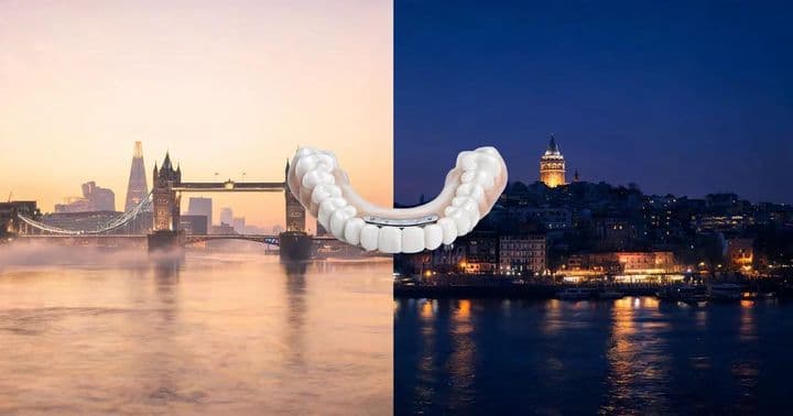 Londra'dan Türkiye'ye Tam Ağız İmplantı: Kalın mı, Uçun mu? Adaylık Rehberi (2026)